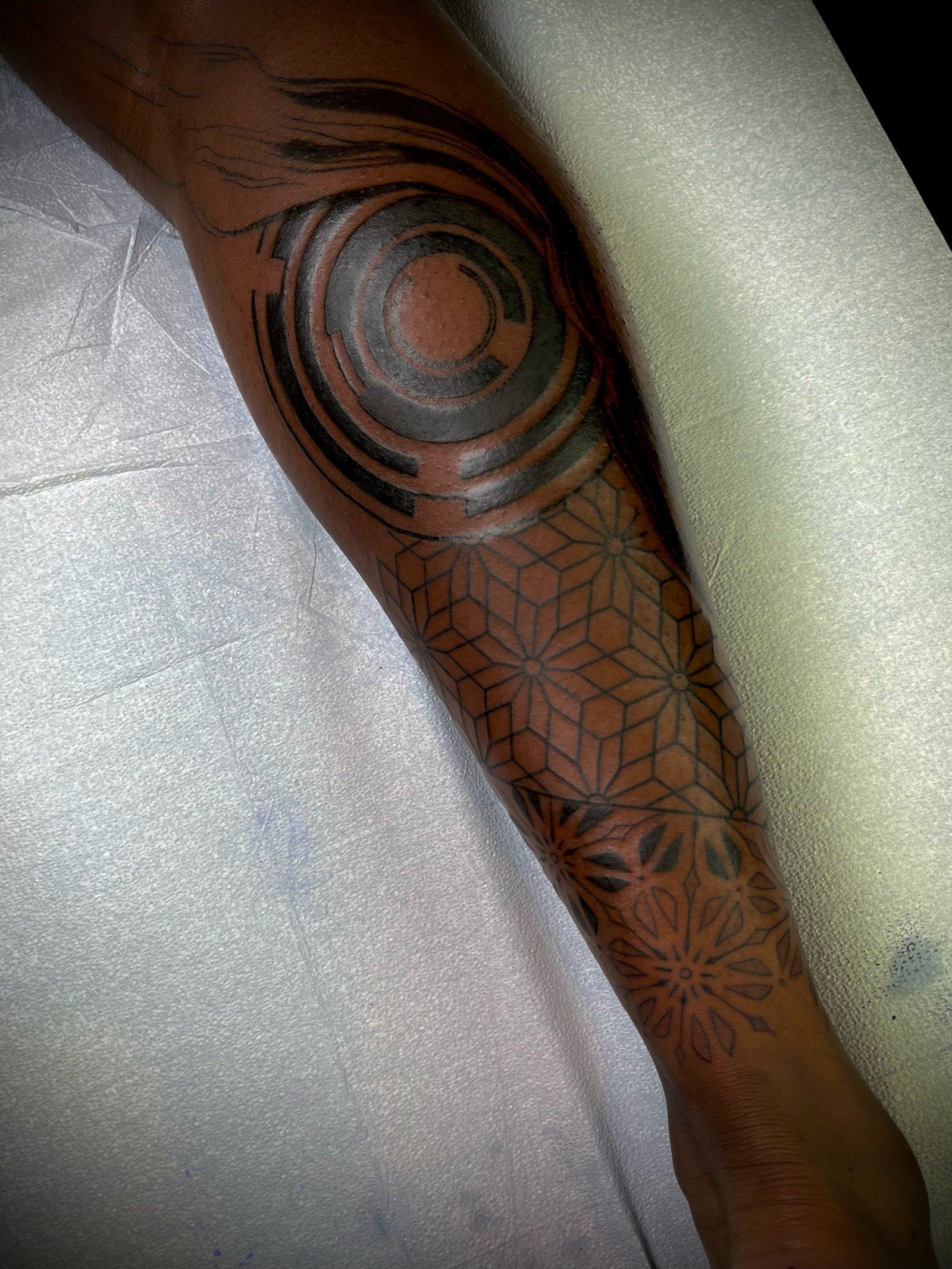 Healed circular tattoo covering the injured leg, close-up